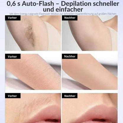 Goldstern - IPL-Haarentferner - LumeaFrost